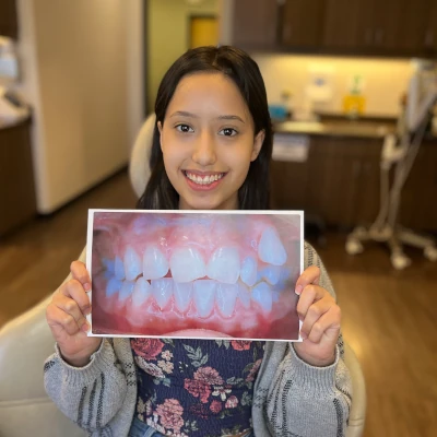 Teen Holding Braces Before & After 5